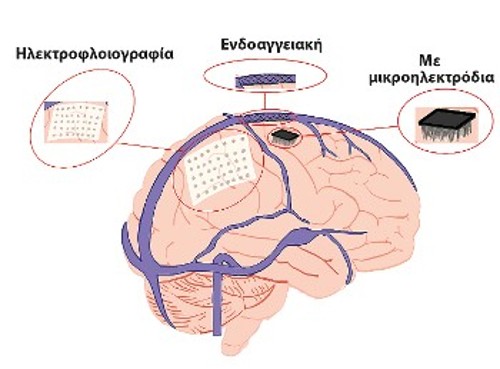 Επεμβατικές και μερικώς επεμβατικές υλοποιήσεις διεπαφών εγκεφάλου - υπολογιστή