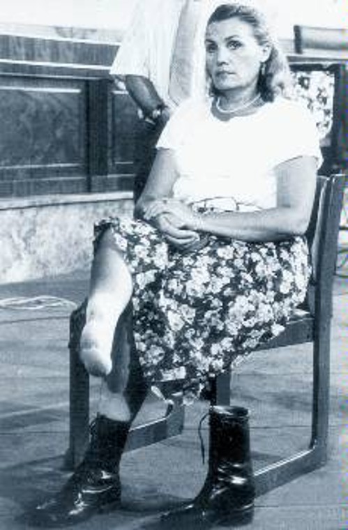 Η Νάνσι Παβόν 40 χρόνια μετά θα πει: «Κατάστρεψαν τη νιότη μου. Ποτέ δεν ένιωσα ευτυχισμένη στη ζωή μου, λόγω του ποδιού μου».