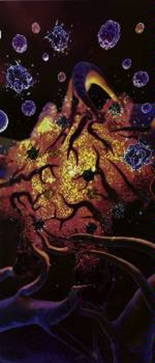 Η ανάπτυξη των όγκων σε ορισμένους καρκίνους προχωράει μέσα από τις παρενέργειες αυτού που οι βιολόγοι ονομάζουν φλεγμονή που «σιγοκαίει». Ο όγκος «στρατολογεί» κύτταρα του ανοσοποιητικού συστήματος, τα οποία παραμένουν γύρω από τον όγκο ή στο εσωτερικό του