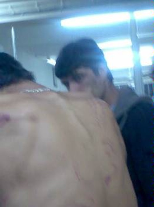 Χτυπήματα στην πλάτη. Η αστυνομία λέει ότι προκλήθηκαν από ...πτώση του 17χρονου.