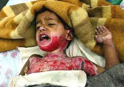 Μικρό παιδί θύμα των πρώτων αμερικανικών βομβαρδισμών στη Βαγδάτη το 2003