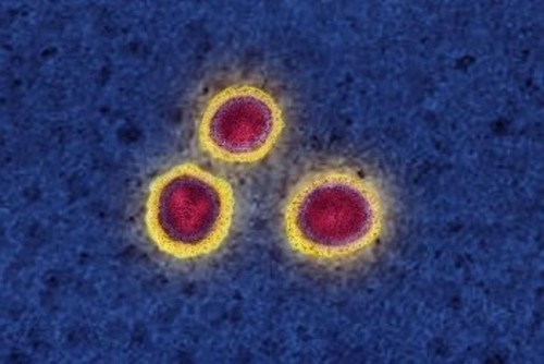 Σωματίδια SARS-CoV-2.