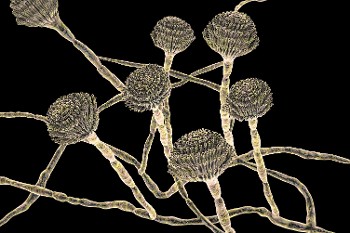 Ο Aspergillus fumigatus μπορεί να είναι θανατηφόρος για ασθενείς που πάσχουν από γρίπη ή COVID
