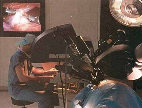 Οι τηλεχειριζόμενες ρομποτικές λαβίδες που χρησιμοποιούνται κατά την εγχείρηση μπαϊπάς απαιτούν ο χειρούργος να κάθεται ένα - δυο μέτρα μακριά από τον ασθενή. Μια οθόνη επιτρέπει στα υπόλοιπα μέλη της ιατρικής ομάδας να παρακολουθούν την εξέλιξη της εγχείρησης