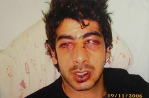 Ο Κύπριος φοιτητής που ξυλοκοπήθηκε άγρια από αστυνομικούς το 2006