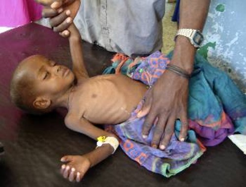 Οι εικόνες που έρχονται από τη Σομαλία με τα σκελετωμένα κορμάκια των μικρών παιδιών αποδεικνύουν την καπιταλιστική βαρβαρότητα