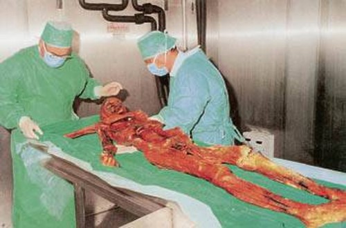 Ιταλοί επιστήμονες εξετάζουν το μουμιοποιημένο σώμα του «ανθρώπου των πάγων», που πέθανε σε ηλικία μεταξύ 45 και 47 ετών