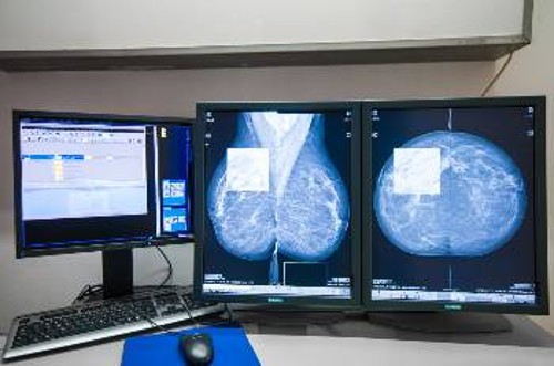 Υπερσύγχρονα μηχανήματα, όπως ο ψηφιακός μαστογράφος, που μπορούν να σώσουν ζωές, χρησιμοποιούνται από τα νοσοκομεία με τη λογική «κόστους - οφέλους»