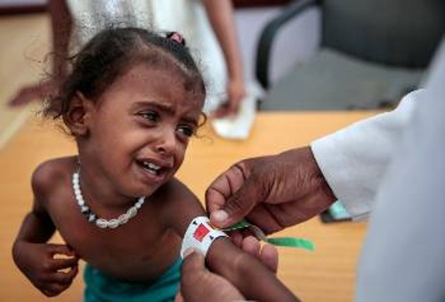 Τα παιδιά είναι τα πρώτα θύματα του πολέμου, αποτέλεσμα της ιμπεριαλιστικής επέμβασης στην Υεμένη. Μόνο τα τελευταία 3 χρόνια έχουν πεθάνει 85.000 από οξύ υποσιτισμό