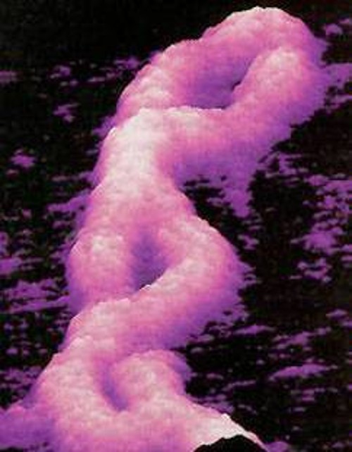 Φωτογραφία τμήματος ενός μορίου DNA από ηλεκτρονικό μικροσκόπιο