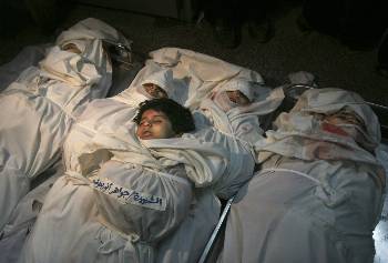 Αυτά τα μικρά παιδιά είναιτα θύματα των ...χειρουργικών χτυπημάτων του Ισραήλ