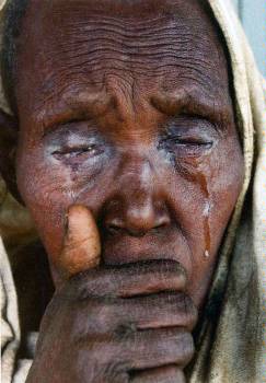 Η τύφλωση (η φωτογραφία από την Αιθιοπία) πλήττει ή οδηγεί στην αναγκαστική μετανάστευση (για να την αποφύγουν) εκατομμύρια ανθρώπους